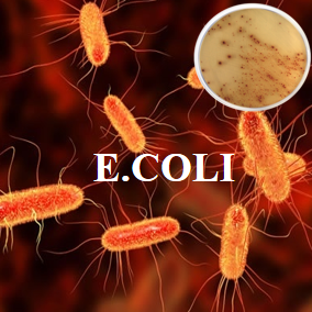 E COLI 75.png